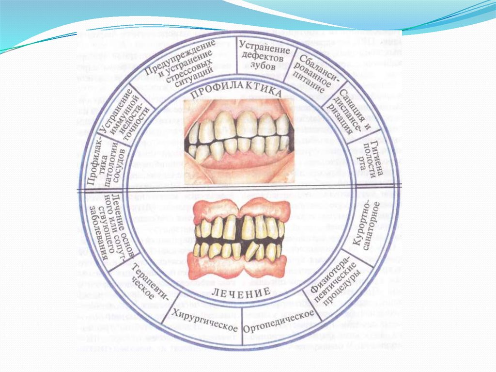Профилактика пародонта. Профилактика заболеваний пародонта. Пародонтит профилактика. Схема профилактики и лечения заболеваний пародонта.