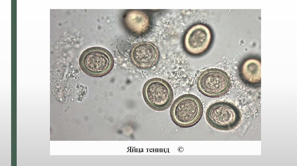 Яйца гельминтов фото под микроскопом