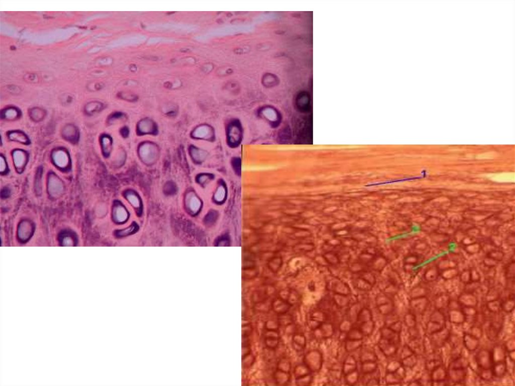 Хрящевая ткань. Хрящевая ткань гистология. Многослойный неороговевающий эпителий хрящевая ткань. Хрящевая соединительная ткань гистология. Эпендимоглиальный эпителий.