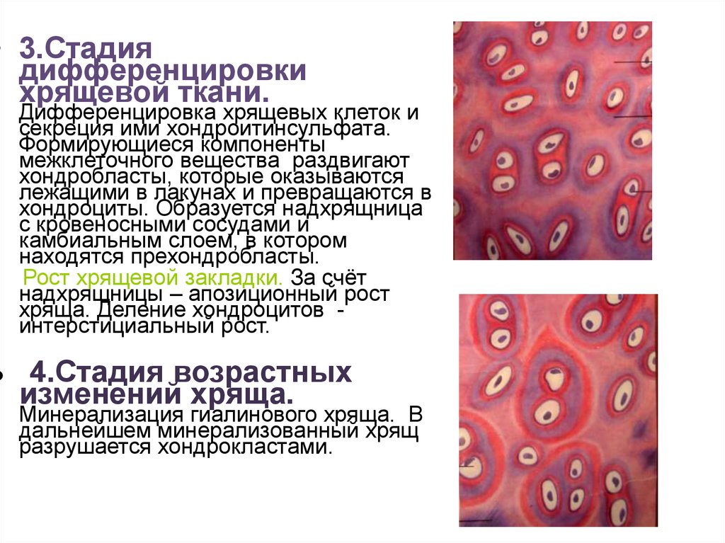 Опухоль из хрящевой ткани. Хрящевые клетки хондробласты хондроциты. Гистогенез хрящевой ткани стадии. Дифференцировка хрящевой ткани гистология. Источники развития клеток хрящевой ткани.