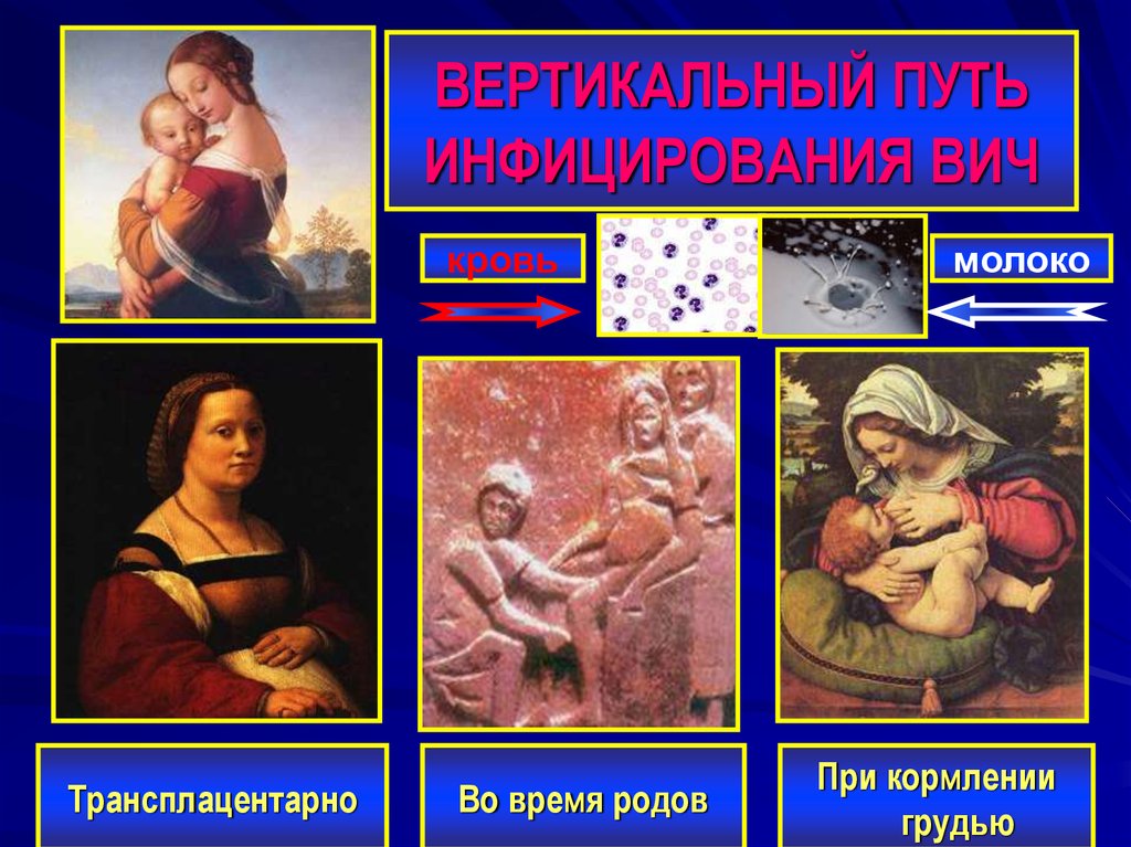 ВЕРТИКАЛЬНЫЙ ПУТЬ ИНФИЦИРОВАНИЯ ВИЧ