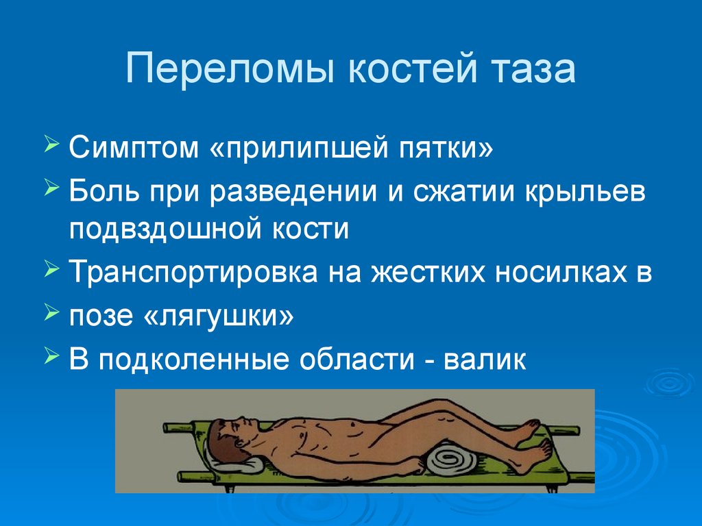 Переломы конечностей таза