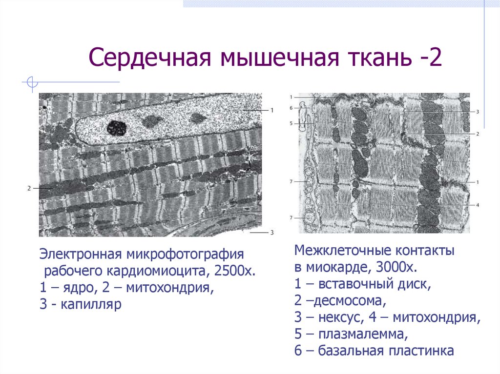 Поперечно полосатая сердечная мышечная ткань гистология рисунок