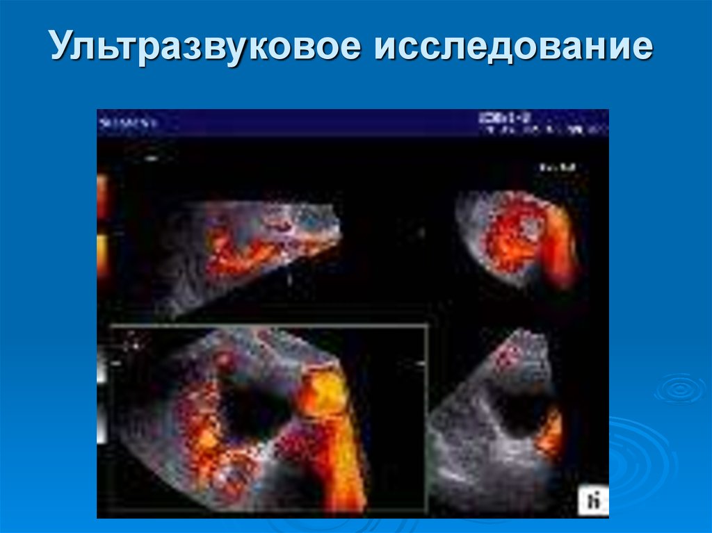 Ультразвуковое исследование иллюстрированное руководство джейн олти эдвард хойт