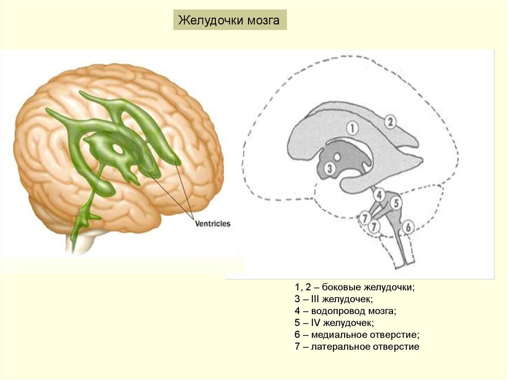 Желудочки мозга схема