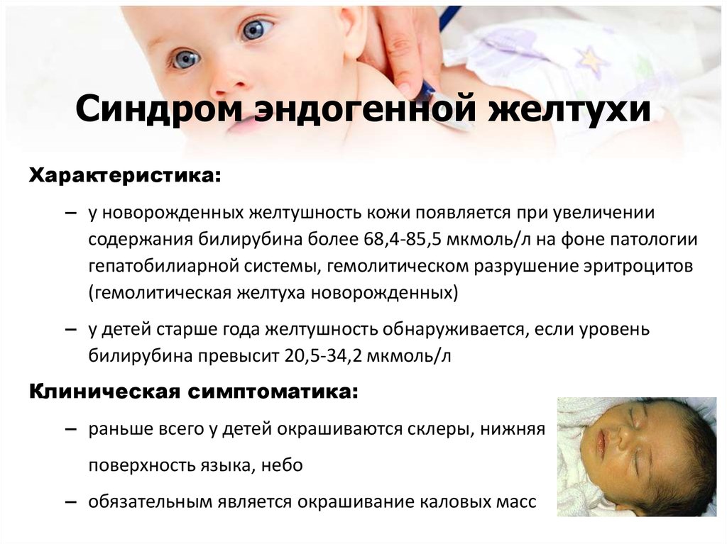 Синдром вялого ребенка. Физиологическая желтушка у новорожденных норма. Признаки желтухи у новорожденных 2 месяца. Желтушка у новорожденных причины. Причина желтушки у новорожденного.
