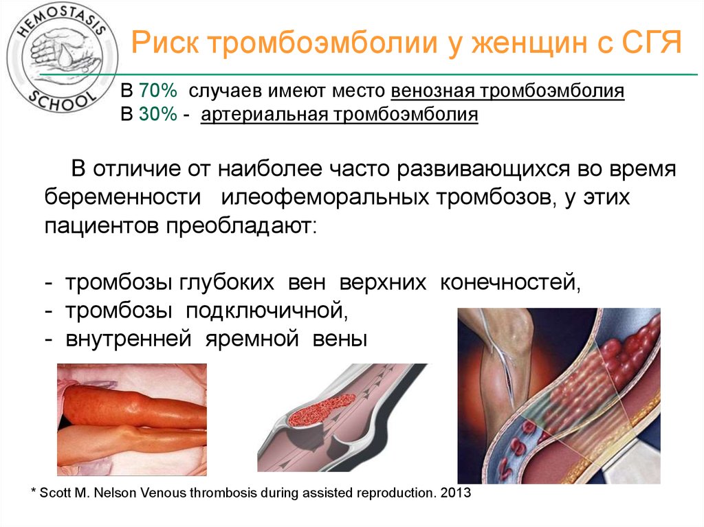 Тромбоз карта вызова