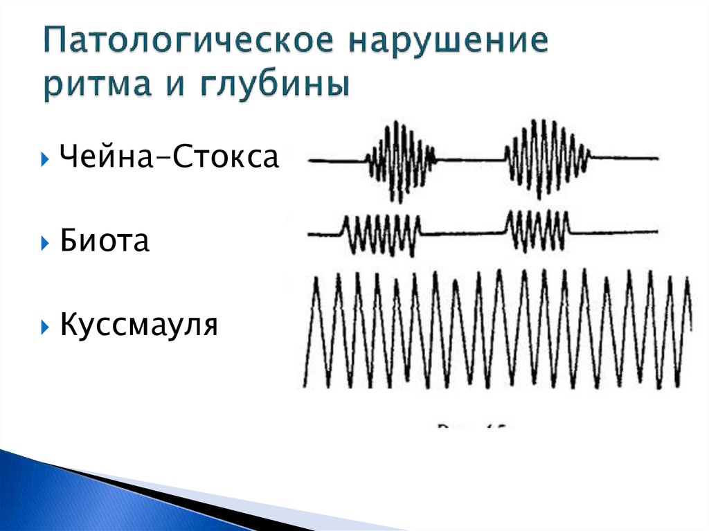 Графическое изображение дыхания