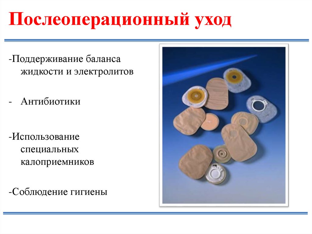 Послеоперационный уход