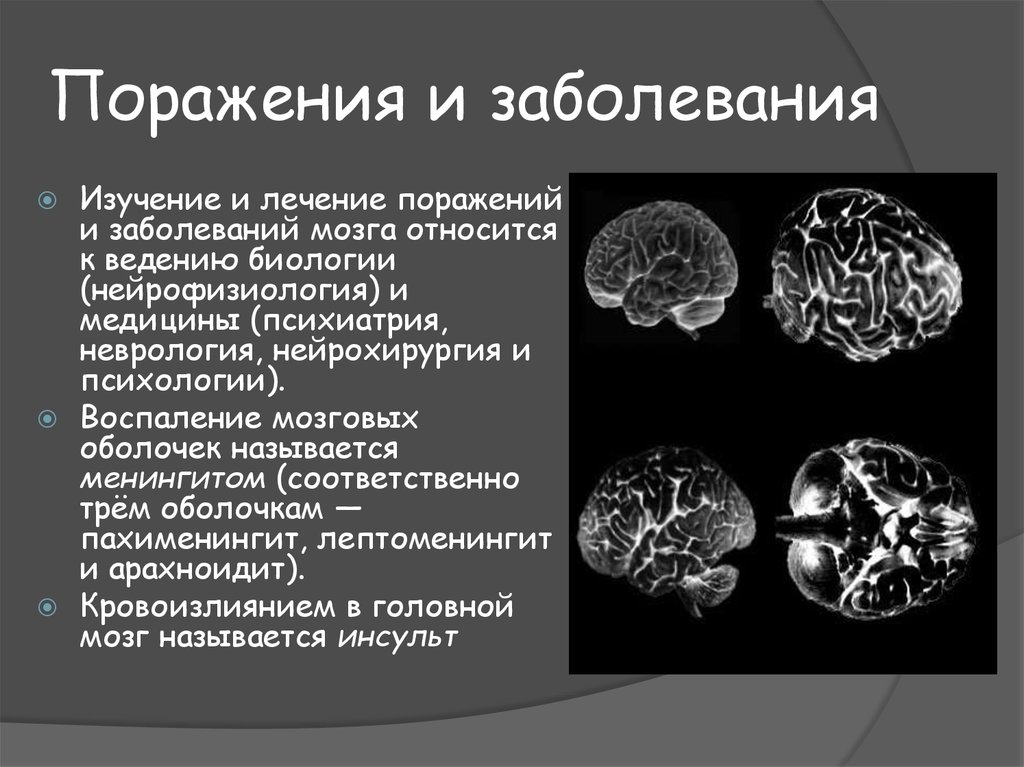 Болезни мозга названия. Название болезней головного мозга перечень. Поражение головного мозга. Патология головного мозга. Болезнь головного мозга название болезни.