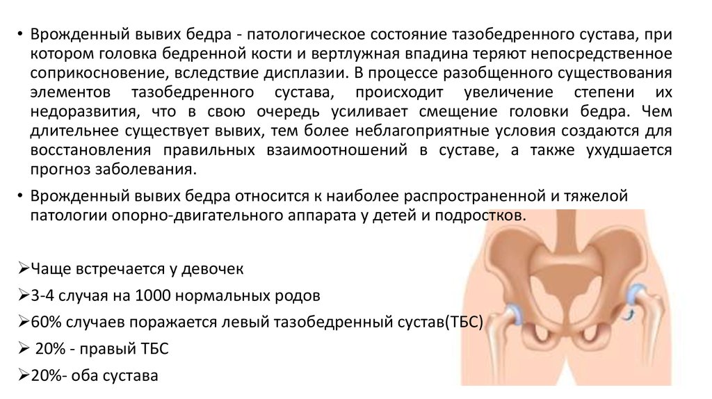 Врожденный вывих бедра. Врожденный подвывих тазобедренного сустава. Врожденный вывих бедра двусторонний. Врожденный вывих головки бедра. Врождённый вывих тазобедренного сустава у детей.