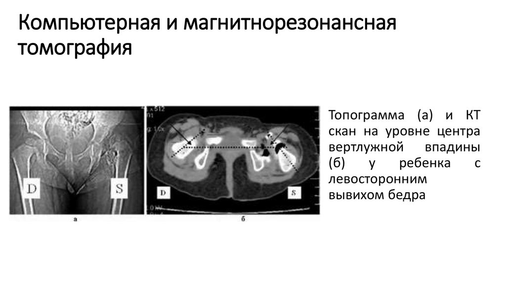 Компьютерная и магнитнорезонансная томография