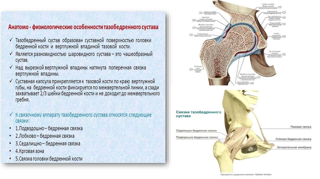 Вывих бедра презентация