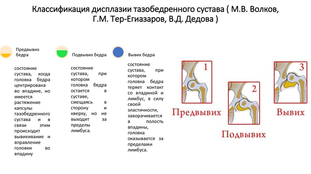 Врожденные вывихи бедра презентация