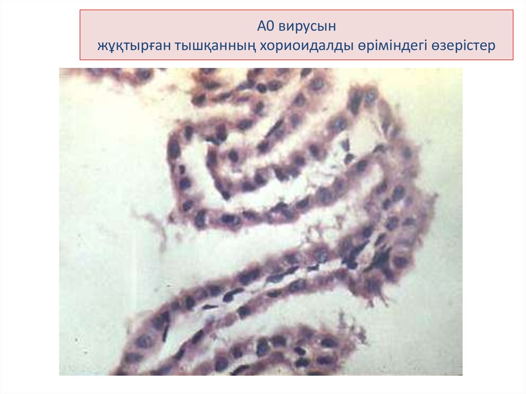 А0 вирусын жұқтырған тышқанның хориоидалды өріміндегі өзерістер