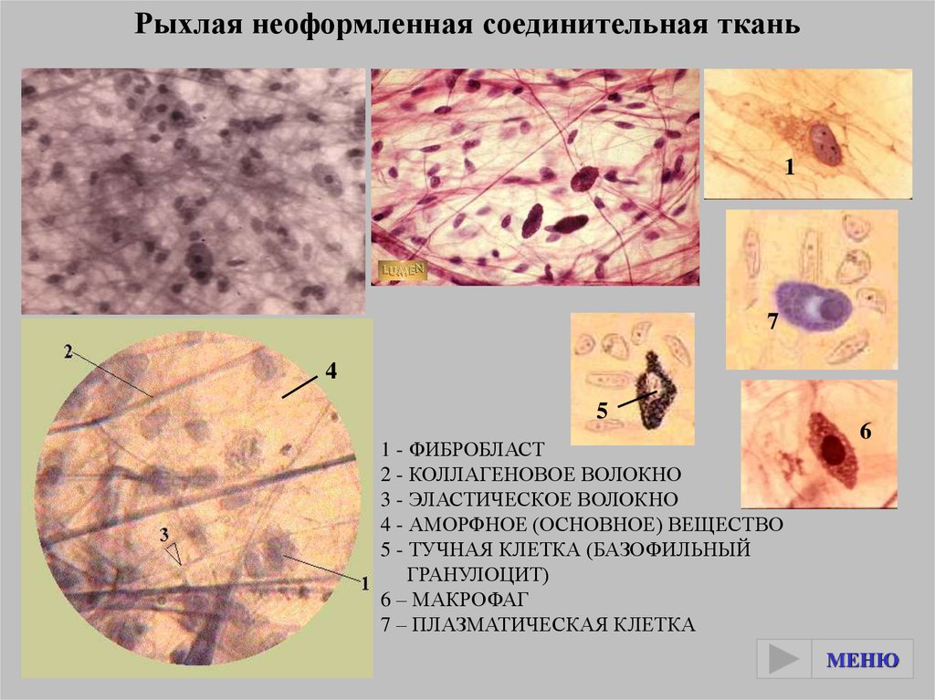 Рыхлая волокнистая неоформленная соединительная ткань рисунок с подписями