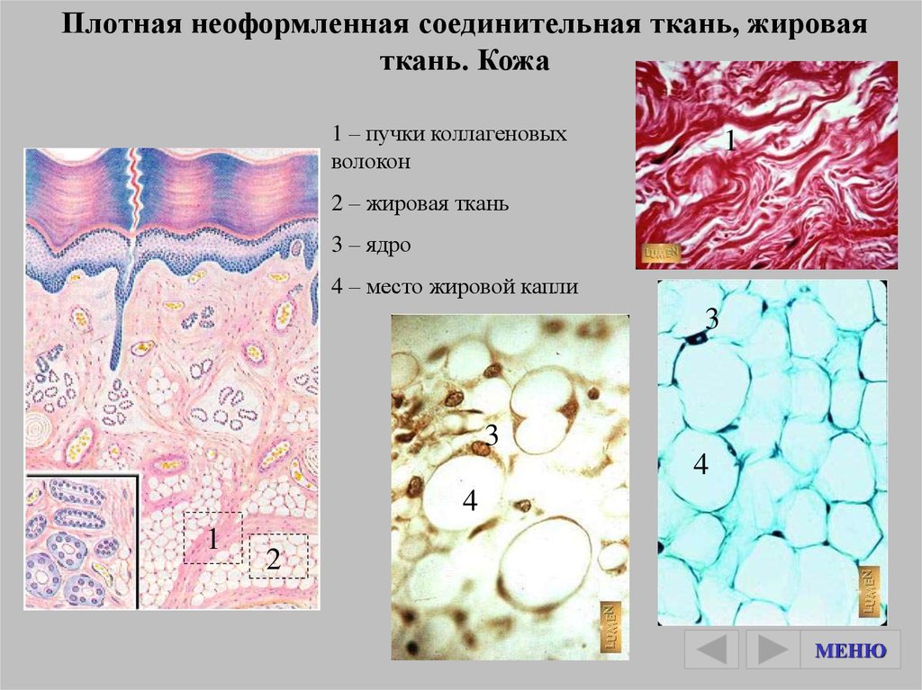 Плотная неоформленная соединительная ткань