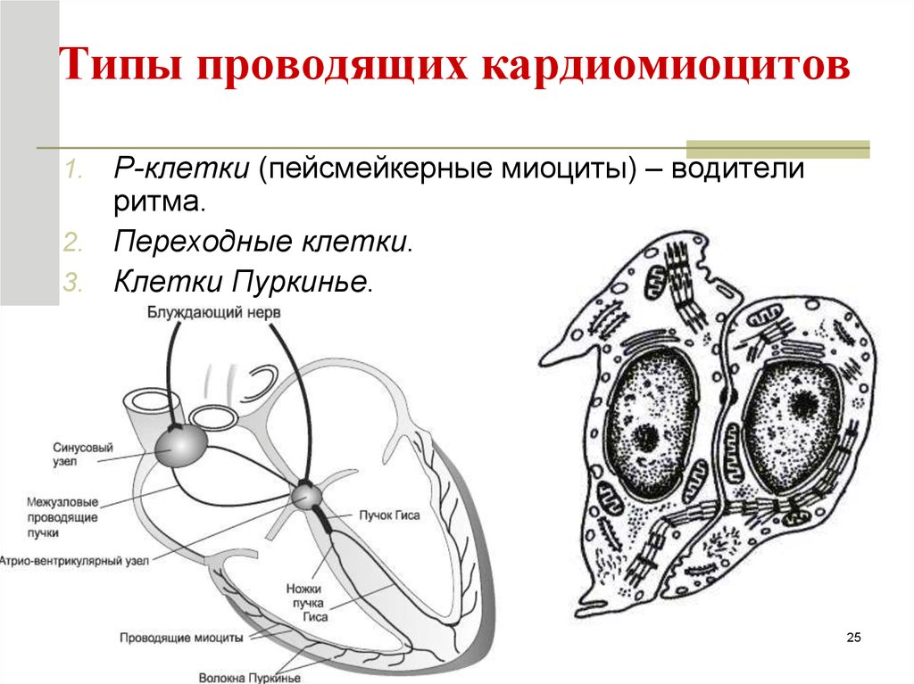 Атипичные кардиомиоциты рисунок