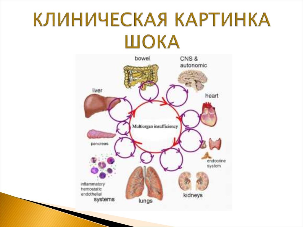 Картинка клиническая картина