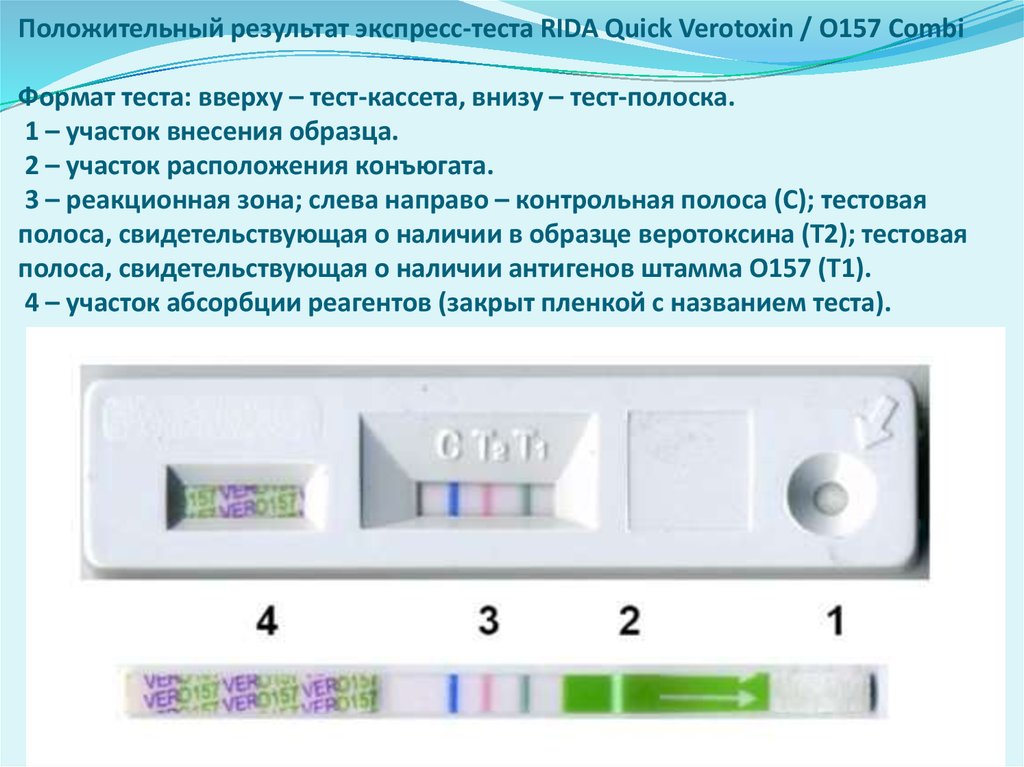 Есть тест на коронавирус положительный. Экспресс тест на ковид т1 т2. Тест кассета теста на ковид. Положительный результат экспресс теста на коронавирус. Экспресс тест экспресс тест экспресс тест.