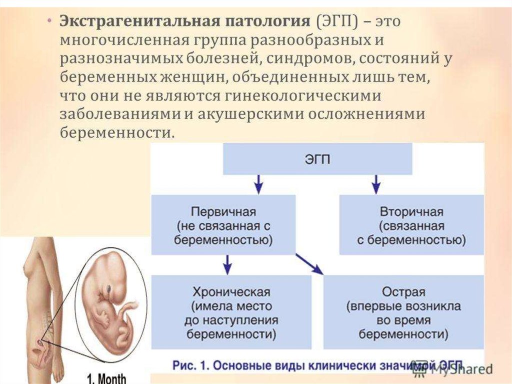 Течение ведение беременности. Экстрагенитальная патология и беременность. Экстрогенитальная потологи. Экстро генитальные патологии. Экстра генитатальная патология это.