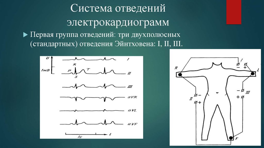 Электроды экг стандартные отведения. Усиленные однополюсные отведения ЭКГ. ЭКГ отведения Эйнтховена. Стандартное и усиленное отведение ЭКГ. Стандартные отведения от конечностей ЭКГ.