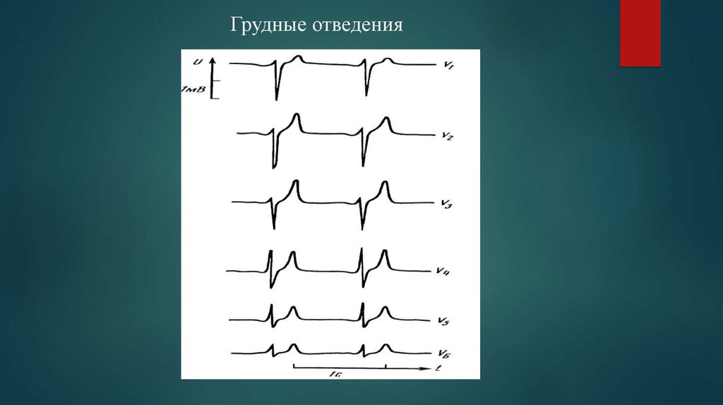 Грудные отведения