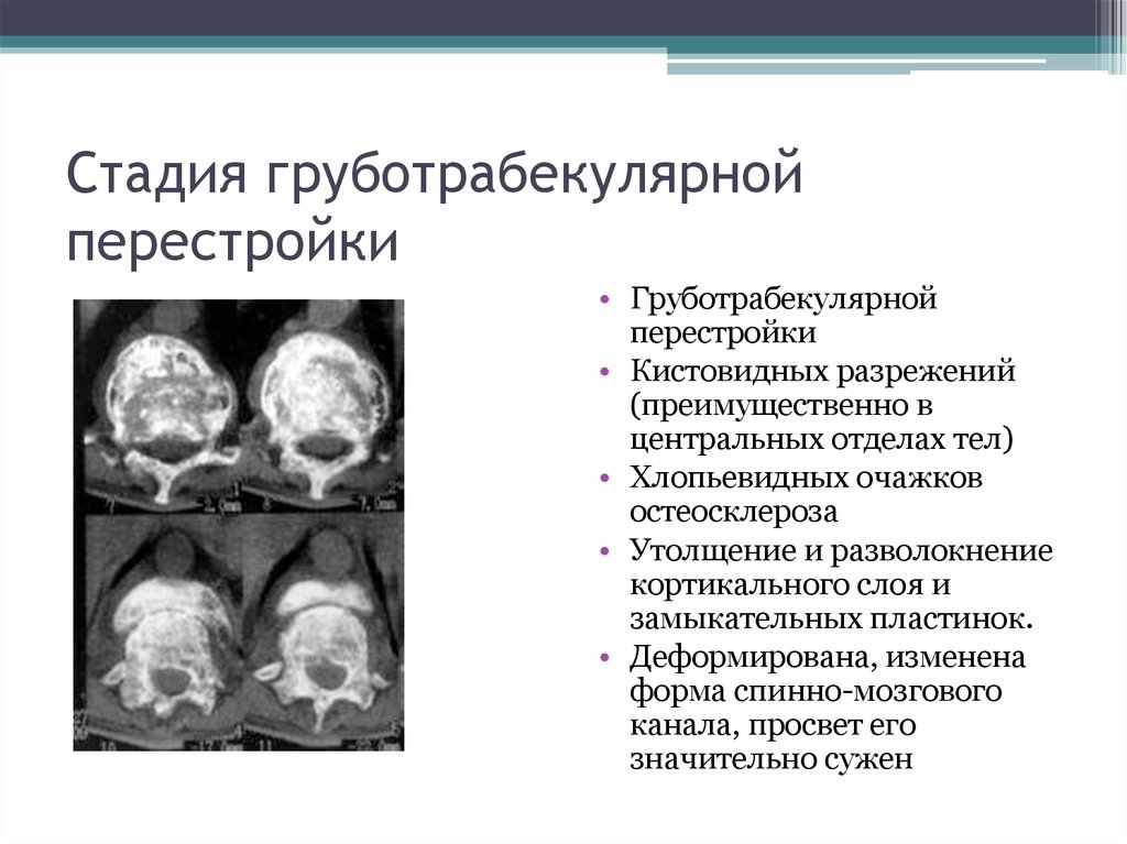 Болезнь педжета презентация