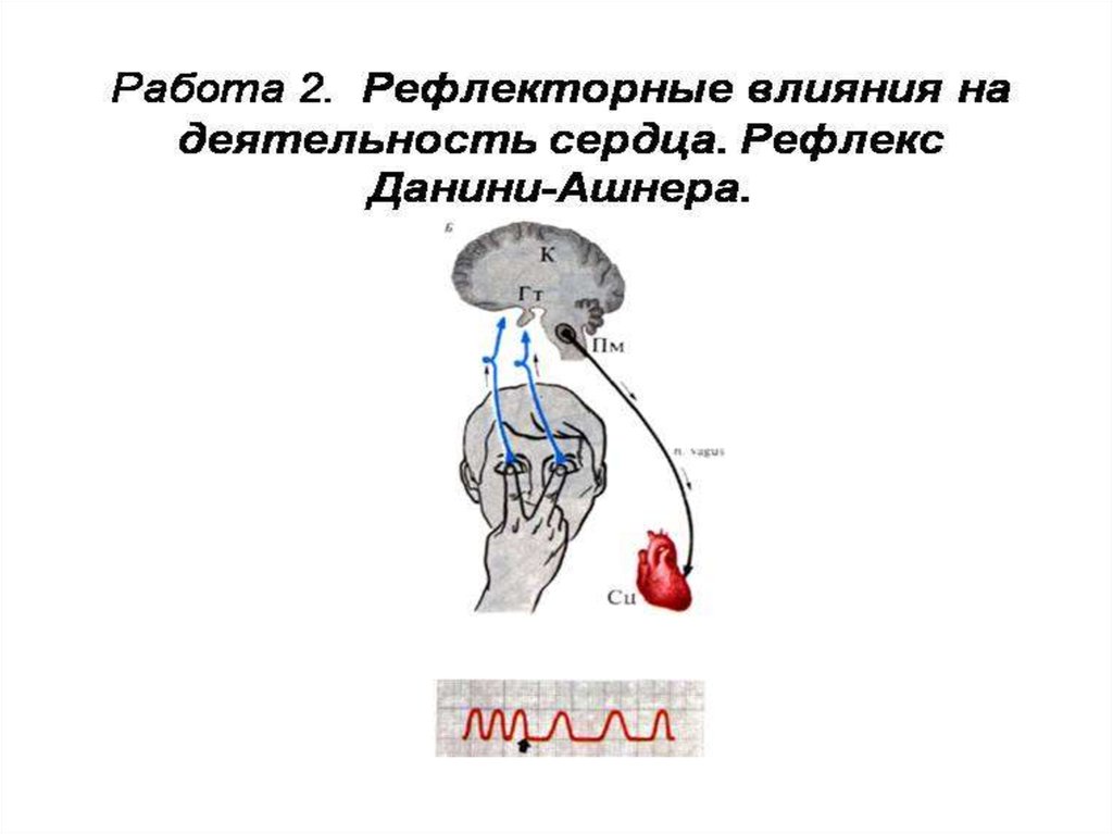 Схема рефлекторной дуги глазосердечного рефлекса