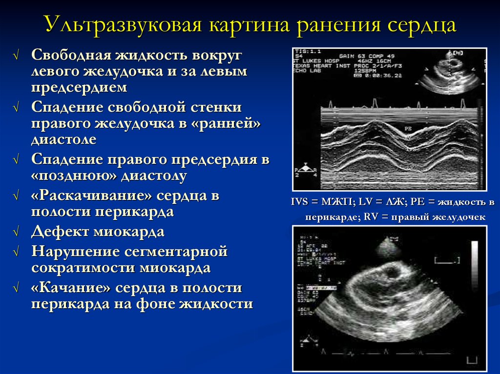 А сколько в сердце ран