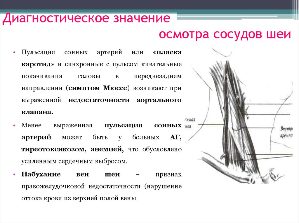 Пульсирующие артерии