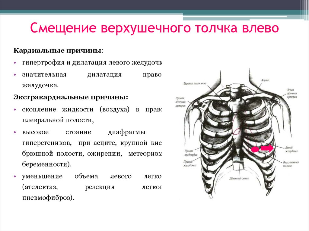 Свойства верхушечного толчка