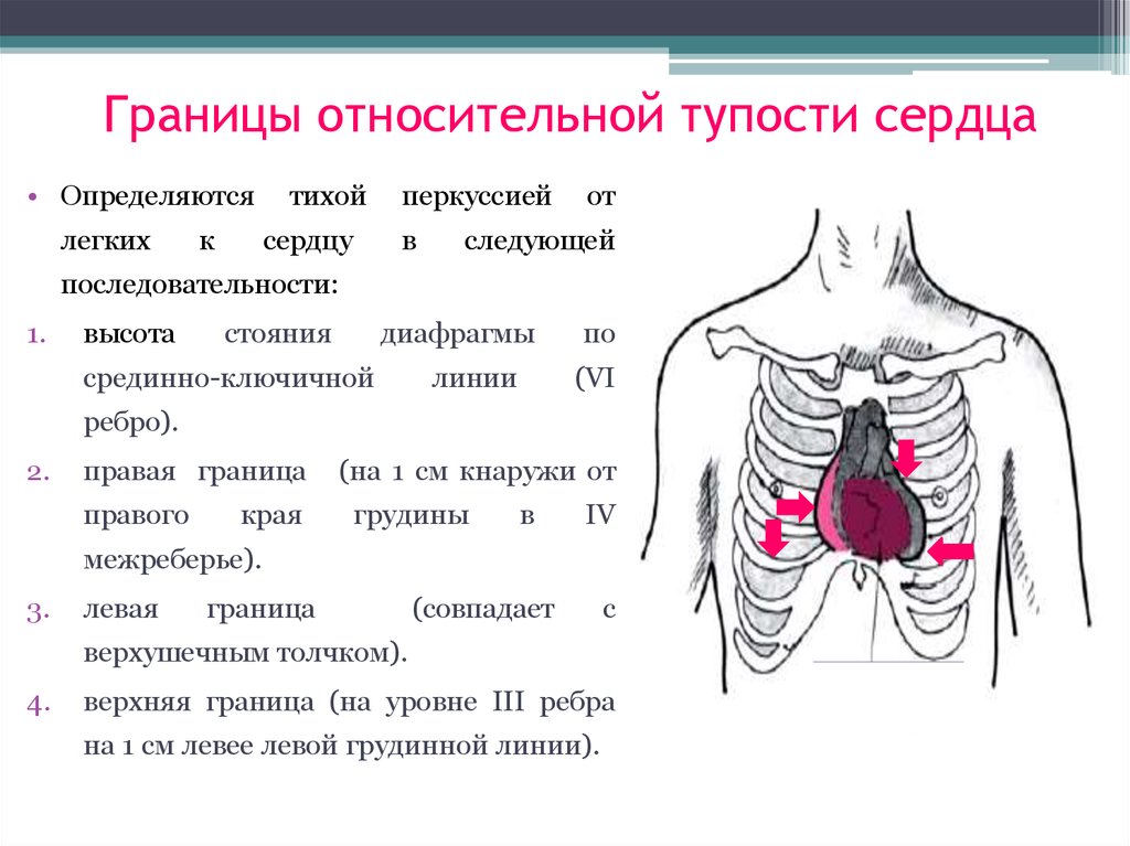 Относительная тупость сердца. Границы относительной тупости сердца в норме. Перкуссия границ относительной сердечной тупости. Норма левой границы сердца. Перкуссия сердца Относительная тупость сердца норма.