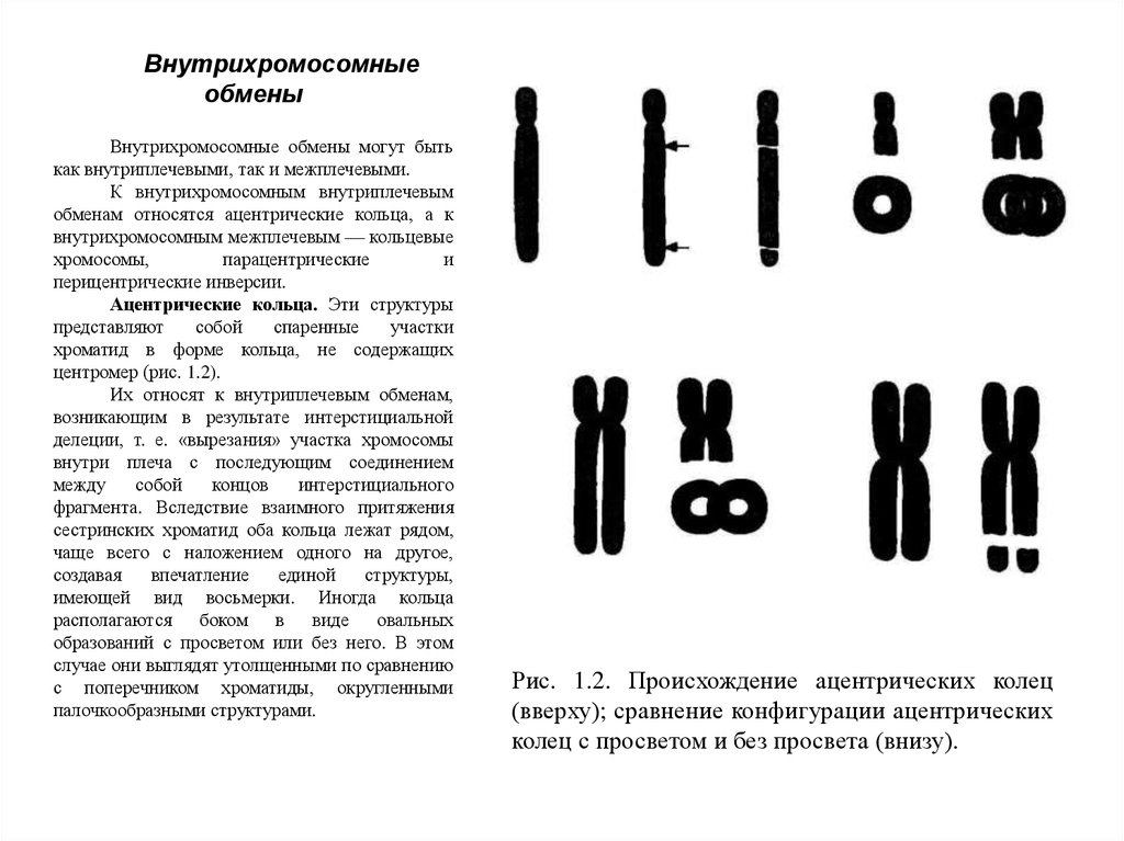 Кольцевая 4 хромосома. Кольцевая хромосома. Дицентрические и кольцевые хромосомы. Ацентрические ФРАГМЕНТЫ хромосом. Хромосомная аберрация Кольцевая хромосома.