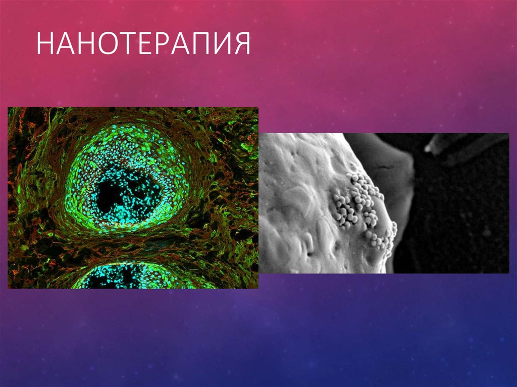 Нанотерапия