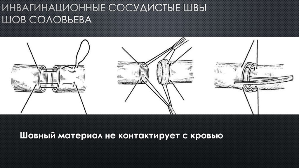 Сосудистый шов топографическая анатомия презентация