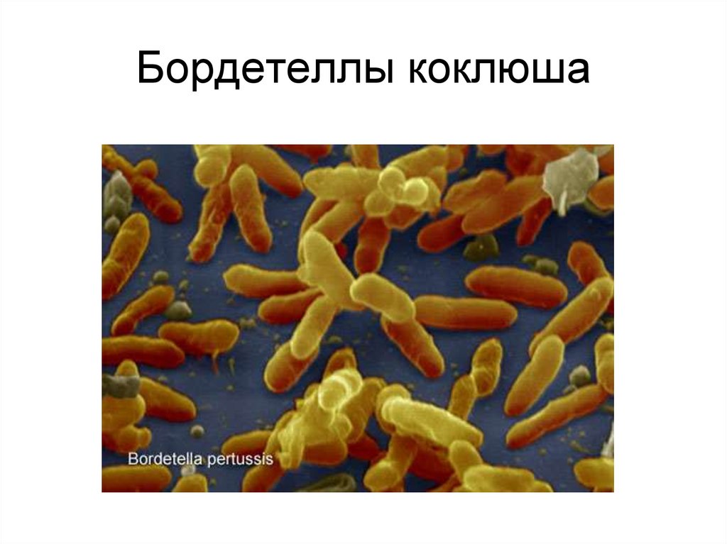 Bordetella pertussis parapertussis. Возбудители коклюша бордетеллы. Возбудитель паракоклюша микробиология. Бордетеллы легионеллы. Бордетелла пертуссис микробиология.