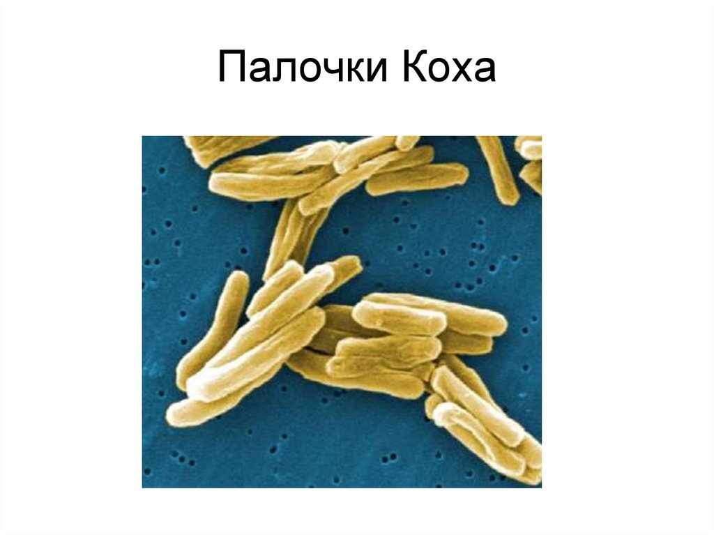 Микробиология кох р открытие туберкулезной палочки. Туберкулезная палочка. Палочки бациллы.