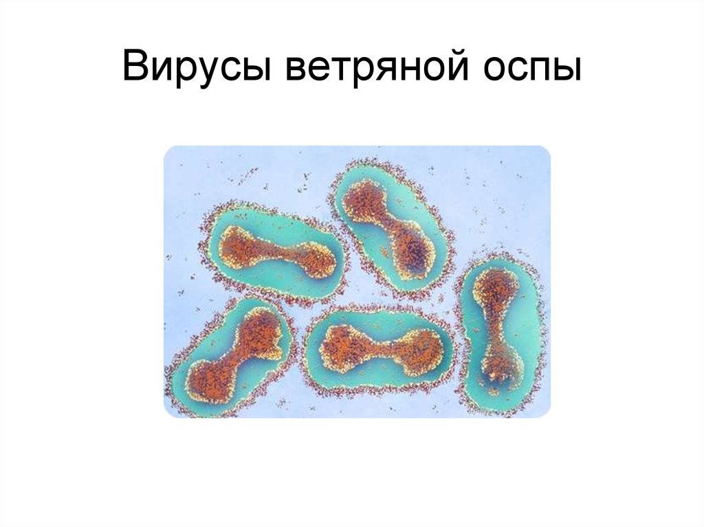 Вирус ветряной оспы. Ветряная оспа возбудитель. Вирус ветряной оспы микробиология. Вирус ветряной оспы строение. Ветряная оспа микробиология строение.