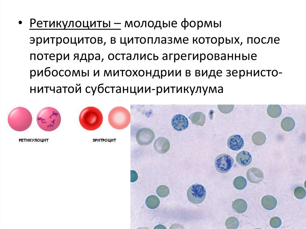 В схеме кроветворения ретикулоциты относятся к классу тест