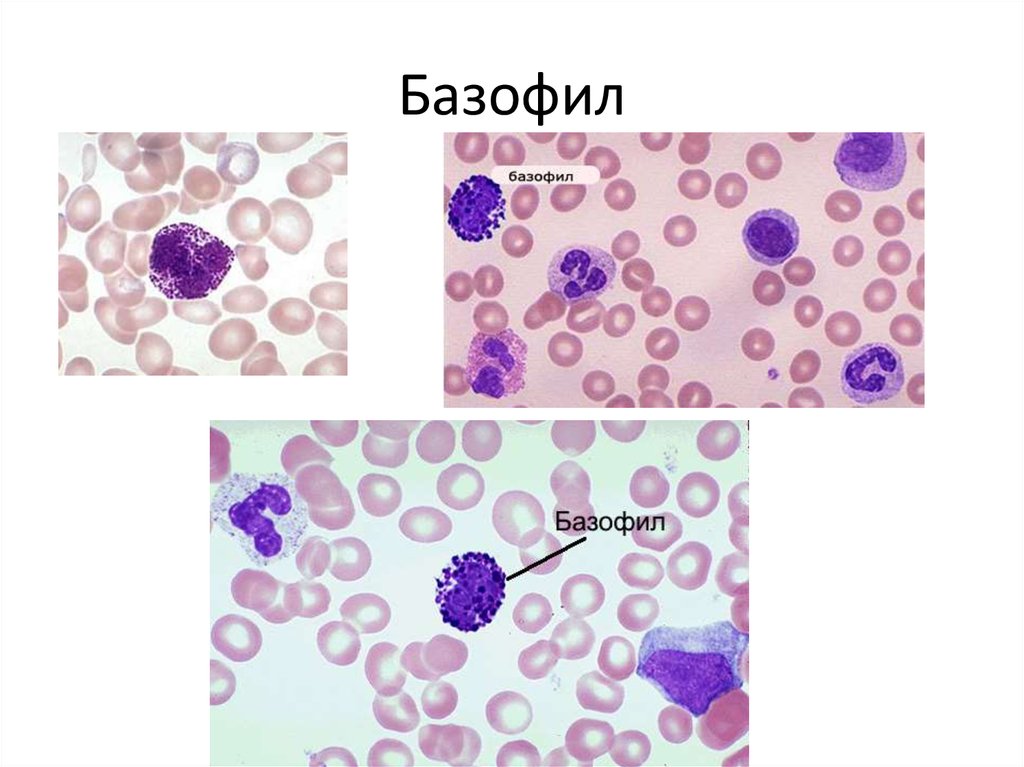 Тучные клетки фото под микроскопом