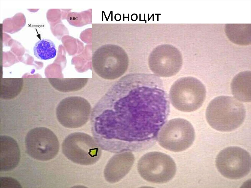 Моноциты в крови картинки