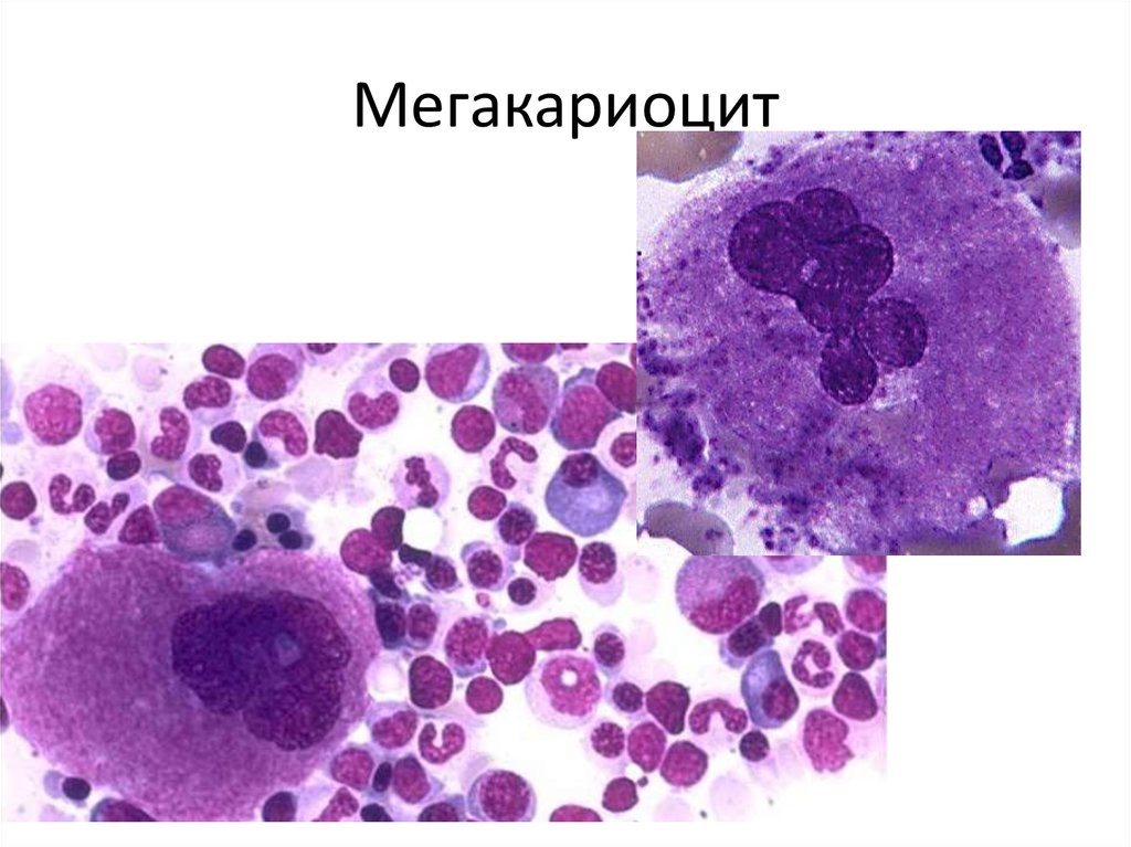 Мазок красного костного мозга рисунок