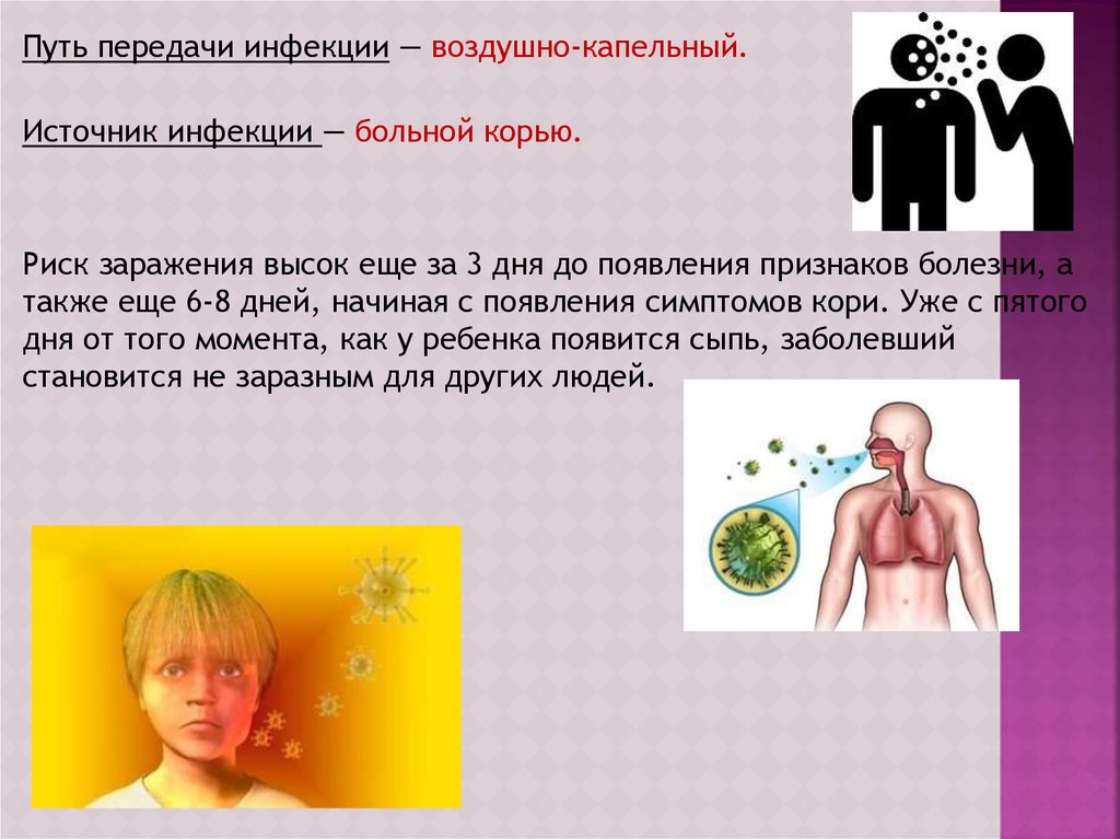 Корь профилактика презентация