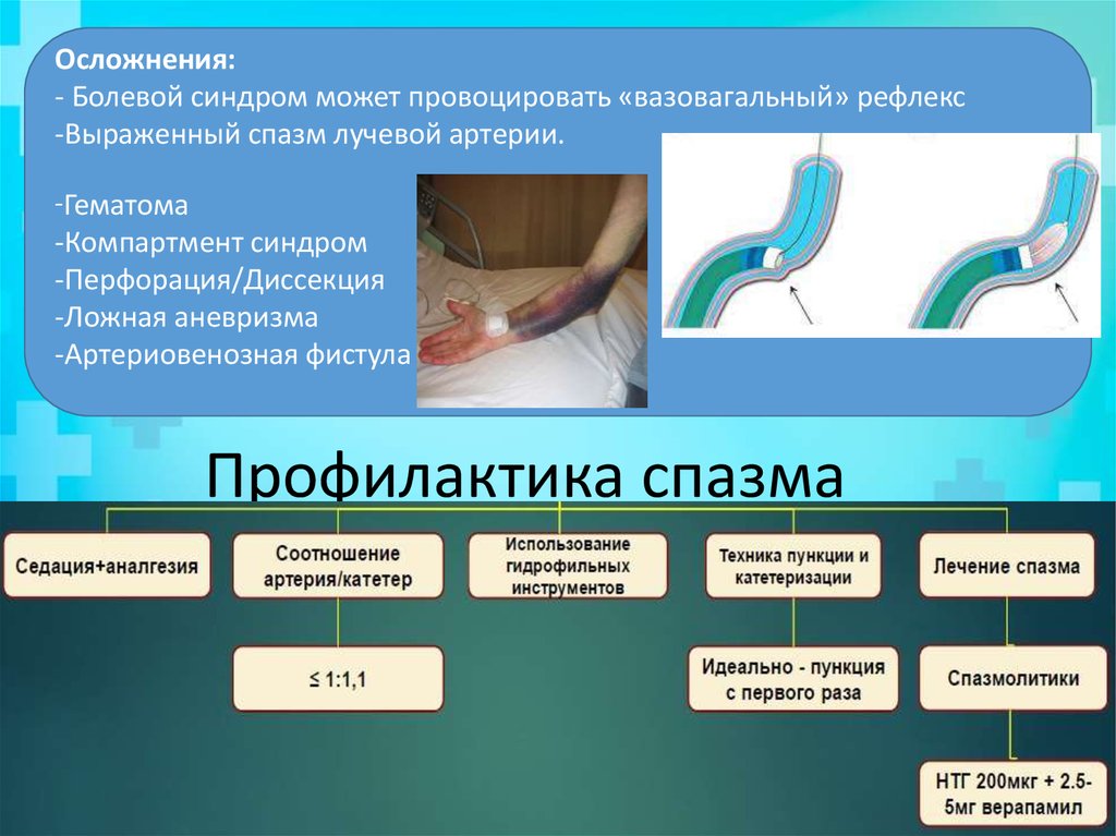 Профилактика спазма