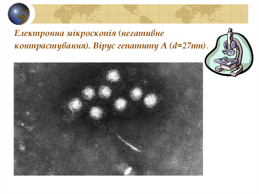 Електронна мікроскопія (негативне контрастування). Вірус гепатиту А (d=27nm).