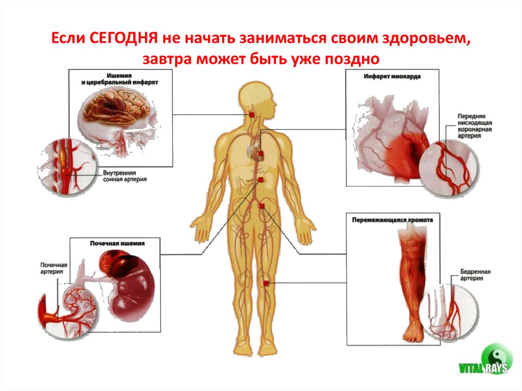 Сердечно-сосудистая система - презентация онлайн