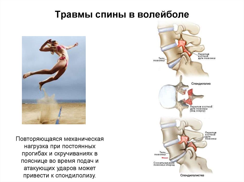 Волейбол пас схема