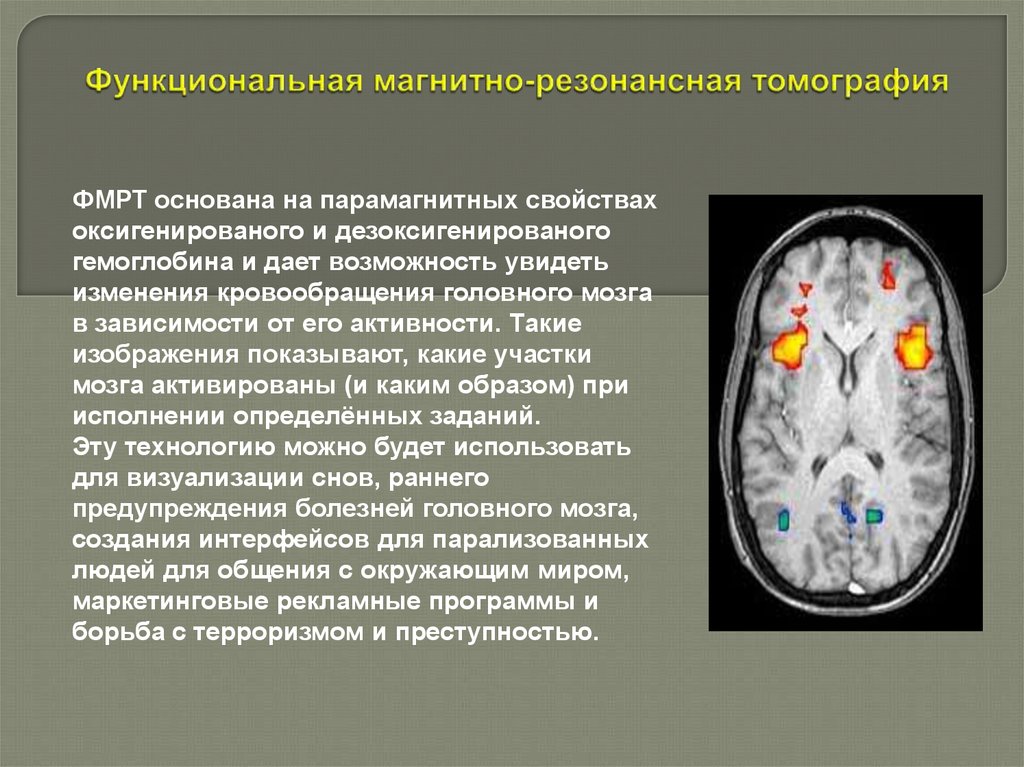 Функциональные состояния головного мозга