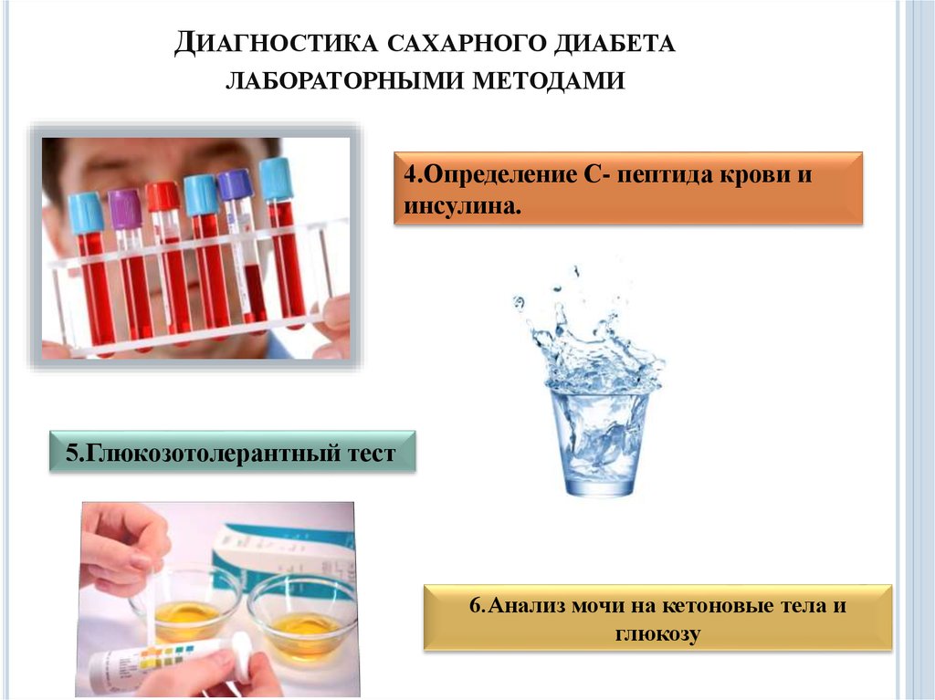 Диагностика сахарного диабета презентация